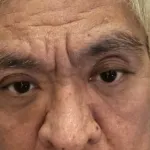 【画像】松本人志さん、まぶたの枚数が多い　想像の数枚多い