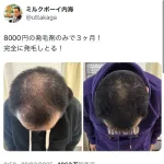 【画像】ミルクボーイ内海　頭髪が完全復活