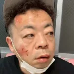 ダイアン、熱中症で死にかける