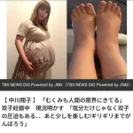 【画像】中川翔子さん、足もパンパンに「むくみもひどくて人間の限界にきてる」