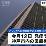 【国内初】アフリカ渡航歴のある20代女性がエムポックスウイルス（サル痘）に感染