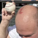大谷の55号HR球をキャッチした男性、手すりに頭頂部をぶつけて出血