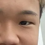 【悲報】ゆたぼん、事故の治療費をネットで乞食して整形代に使ってる疑惑浮上ｗｗｗｗｗｗ