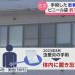 【うっかり】体内に手術で使用のビニール袋を置き忘れ 手術から約1か月後に腹部痛みで発覚