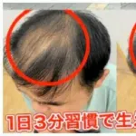 育毛剤広告に措置命令 使用前後の比較画像は〝加工〟によるもの