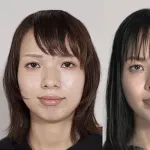 【悲報】顔面整形に5000万円つぎ込んだ美容外科医さんの「無加工ショット」がヤバすぎるｗｗｗｗｗｗｗｗｗｗ