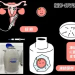 【悲報】国さん、未婚女性の卵子凍結補助を35歳までに制限してしまう・・・・・・・・・