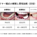 【悲報】親が子供の頃に歯列矯正してくれなかったやつｗｗｗｗｗｗｗｗｗｗ