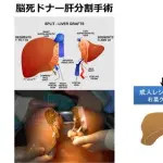 【狂気】人類さん、ついに気づいてしまう「遺伝子操作で頭のない人体を量産して臓器取り出せばよくね?」wwwwwwwwww