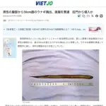 【衝撃】マンさん「お腹痛いよ、タスケテ」→お腹から50cmのウナギが見つかり緊急入院ｗｗｗｗｗｗｗｗｗｗ