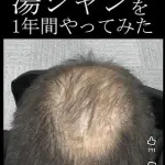 【朗報】ハゲさん、「湯シャン」を1年やった結果ｗｗｗｗｗｗｗｗｗｗ