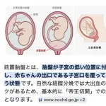 【悲報】妊娠6ヶ月のたぬかなさん、出産まで入院し続ける事態に・・・・・・・・・