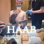 【衝撃】Mattさん、肩ヒアルロン酸注入で理想のハンガー型シルエットになるｗｗｗｗｗｗｗｗｗｗ