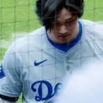 【悲報】大谷翔平さん(31)の頭皮、逝く