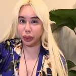 【悲報】アレン様、ここにきてガチで急に叩かれ始めるwwwwwwwwww
