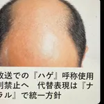 【衝撃】公共放送での『ハゲ』呼称使用を原則禁止へ代替表現は『ナチュラル』で統一方針wwwwwwwwww