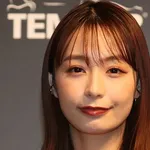 【悲報】「宇垣美里さん（35）」←コイツが天下取れなかった理由ｗｗｗｗｗｗｗｗｗｗ