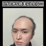 【画像】ハゲさん「かっこいい髪型にして」→結果ｗｗｗｗｗｗｗｗｗｗ