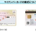 【悲報】マイナンバーカード作ってない奴って病院行くときどうすんの・・・・・・・・・